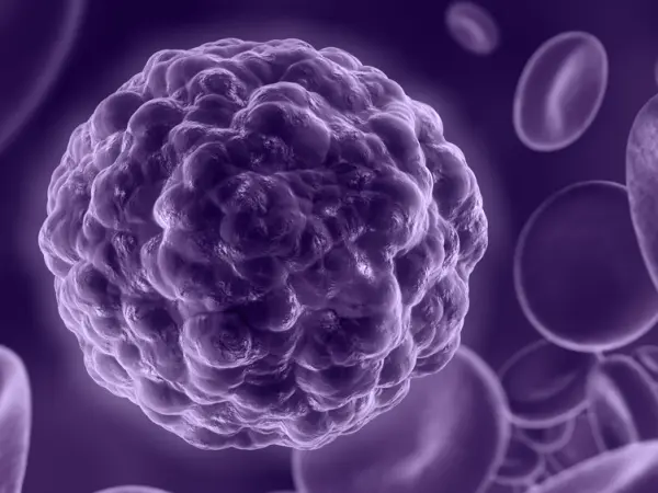 Indolent B-cell lymphomas